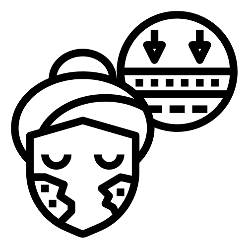 01 MELASMA CHEMICAL PEELING