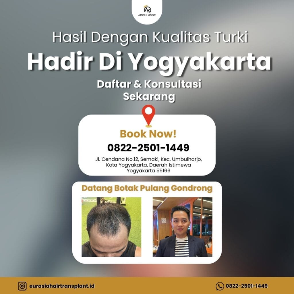 Biaya Tanam Rambut Biaya Tanam Rambut