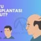 Apa Itu Transplantasi Rambut 2 85x85